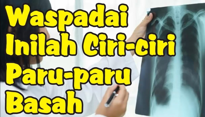 Ciri Ciri Paru Paru Basah